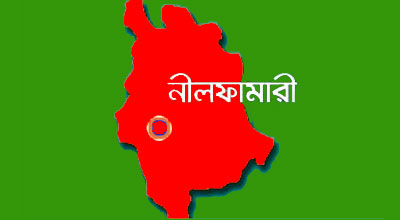 ডোমারে ক্লিনিকে দুই মাথা নিয়ে শিশুর জন্ম